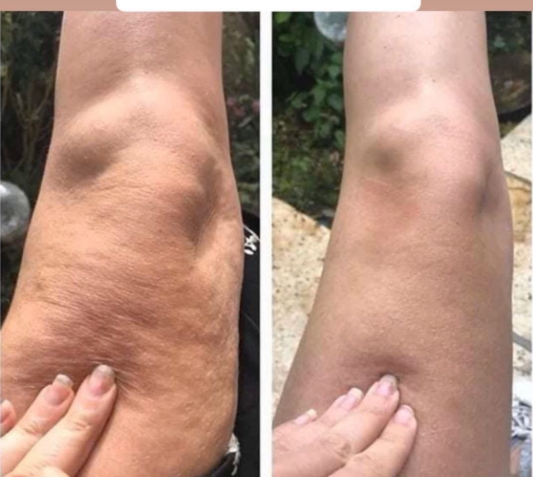 Introductory Dermashape: Package of 4